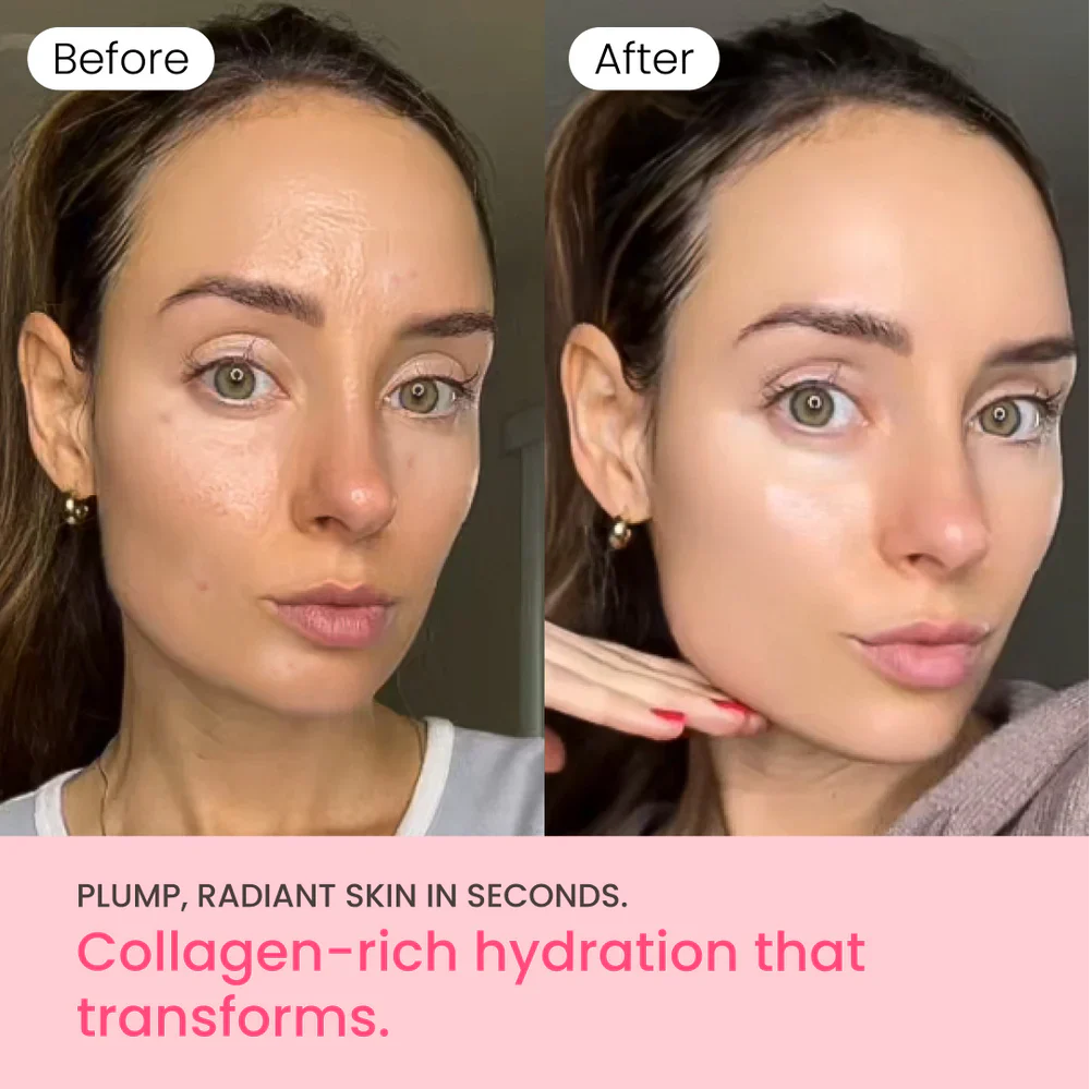 Collagen Jelly Cream with Niacinamide - Image 7
