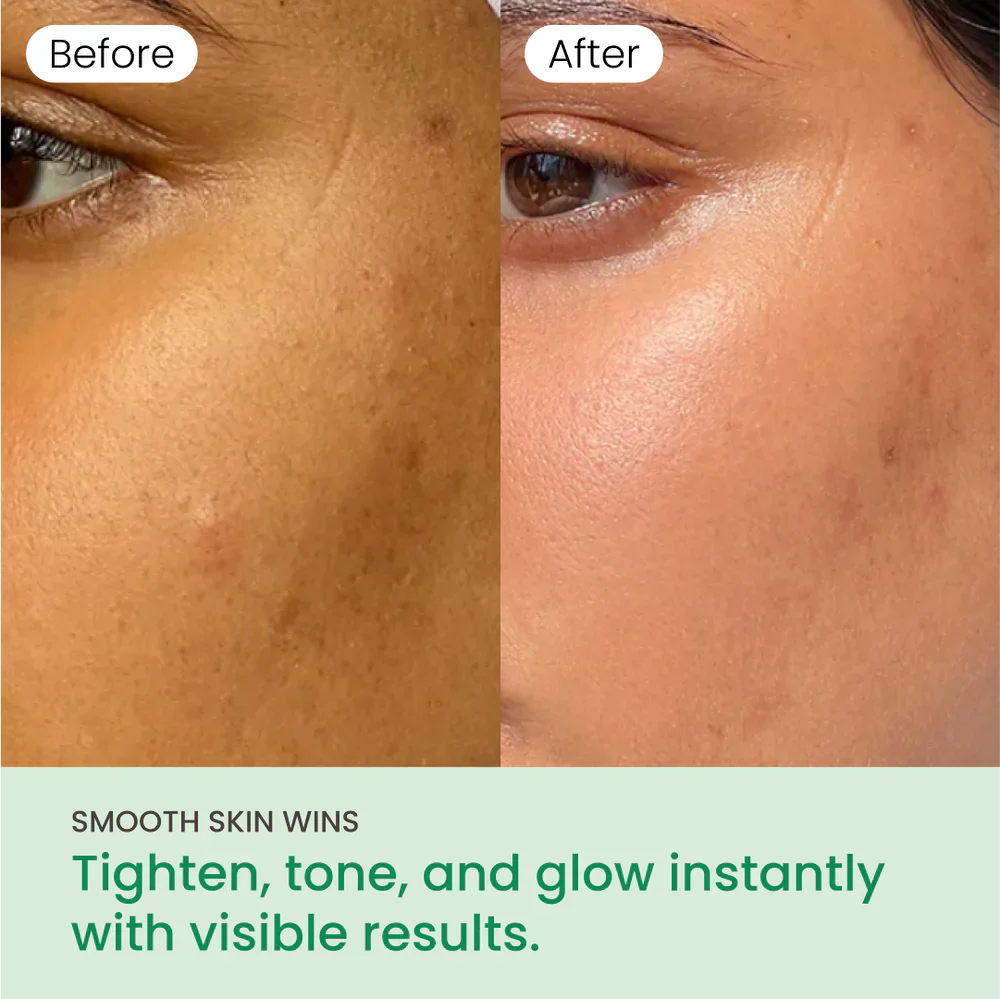 No More Pore Pads - Image 10