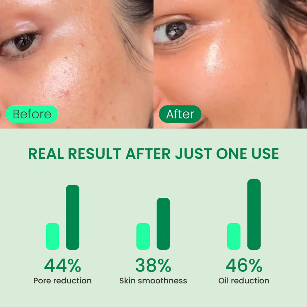 No More Pore Pads - Image 5