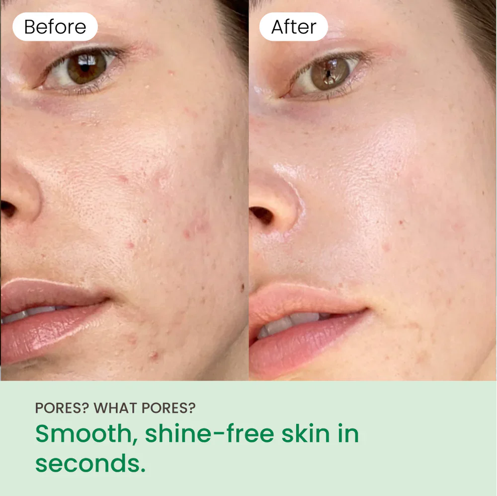 No More Pore Pads - Image 7